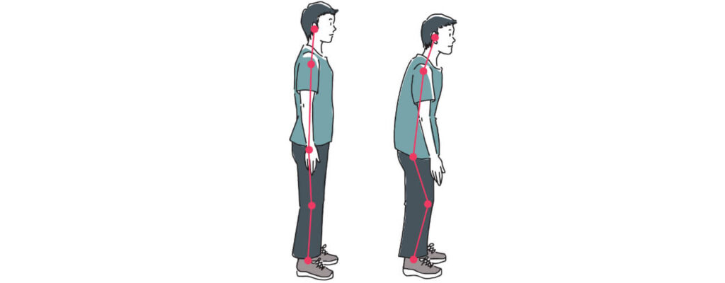 How to Improve Your Posture to Prevent Back Pain